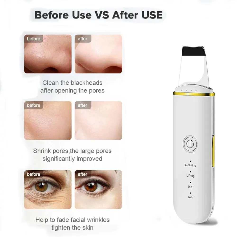 Ultrasonic Skin Scrubber | Deep Cleansing Beauty Tool for Radiant Skin